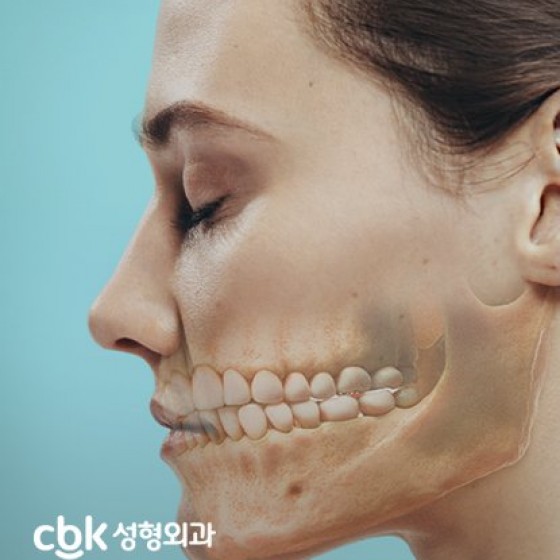 CBK성형외과 병원 홈페이지 제작