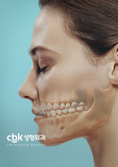 CBK성형외과